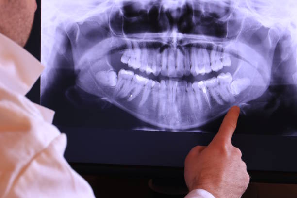 Best Emergency Root Canal Treatment in Fort Washington, PA
