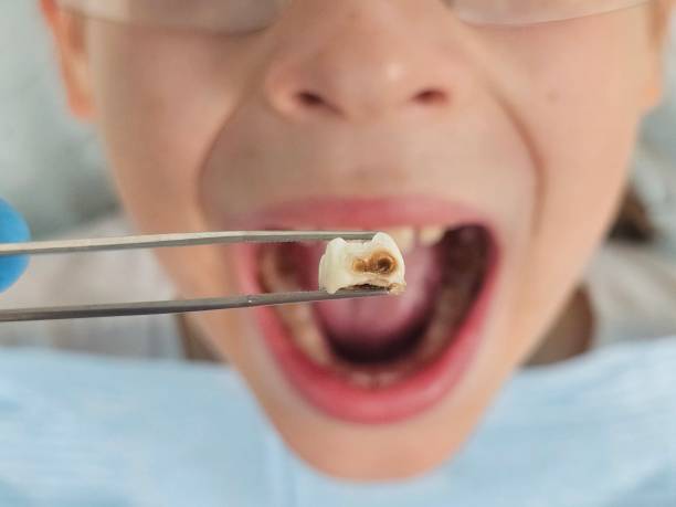 Best Pediatric Emergency Dentist in Fort Washington, PA
